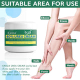 KANZA 40% Urea Cream for Cracked Feet & Hands | Foot Callus & Skin Repair